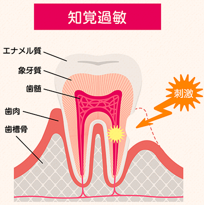 どんな症状？