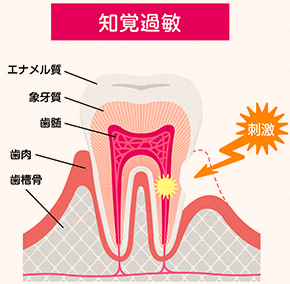 どんな症状？